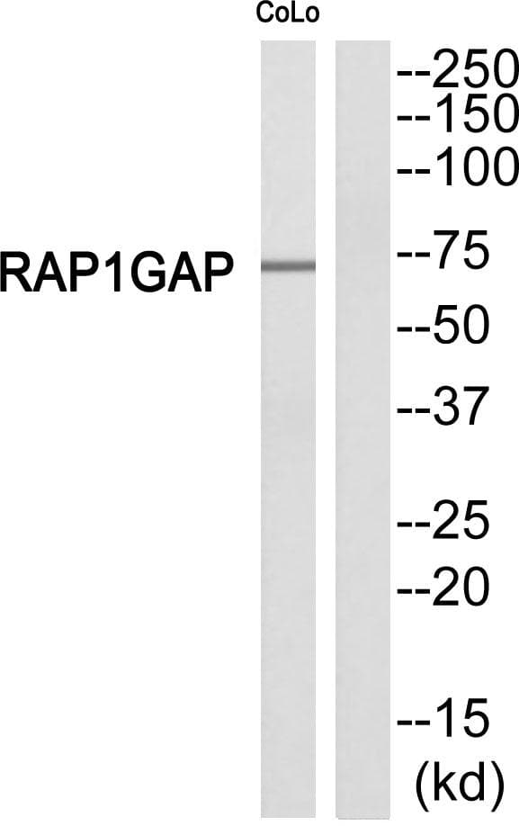 Polyclonal Rabbit anti-Human RAP1GAP Antibody (WB)