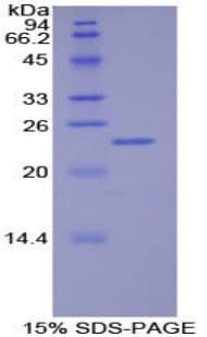 Human MLST8 / GBL Protein (Recombinant His-T7)