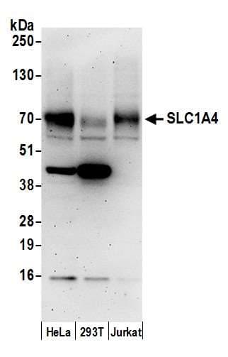 Polyclonal Rabbit anti-Human SLC1A4 / ASCT1 Antibody (aa482-532, WB)