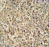 RNASET2 Antibody (aa10-36)