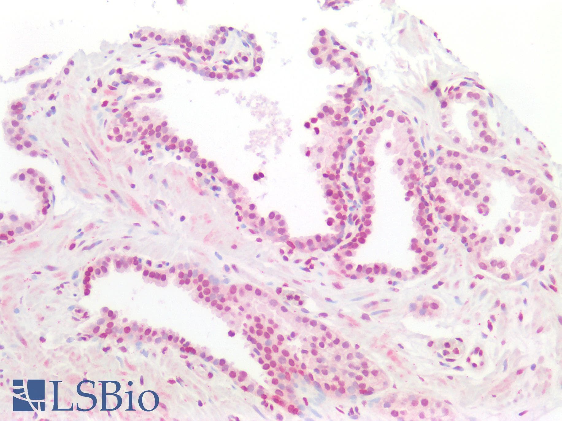 IHC-plus™ Polyclonal Rabbit anti-Human TSHZ1 Antibody (aa656-685, IHC, WB)