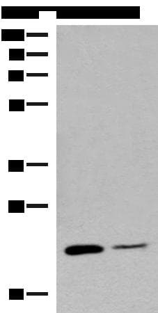 RAC3 Antibody