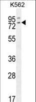 Polyclonal Rabbit anti-Human RASGRP2 Antibody (aa7-34, IHC, IF, WB)