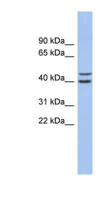 Polyclonal Rabbit anti-Human FBXL14 Antibody (aa35-84, WB)