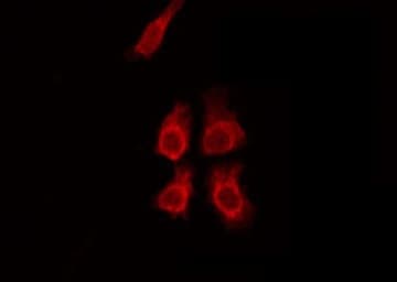 Polyclonal Rabbit anti-Human HSPBAP1 Antibody (IF, WB)