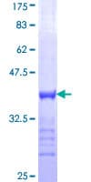 Human MYT1 Protein (Recombinant GST, N-terminus)