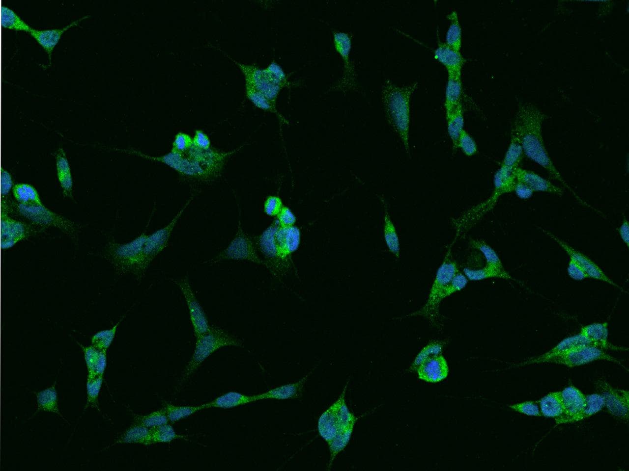 RAB39B Antibody