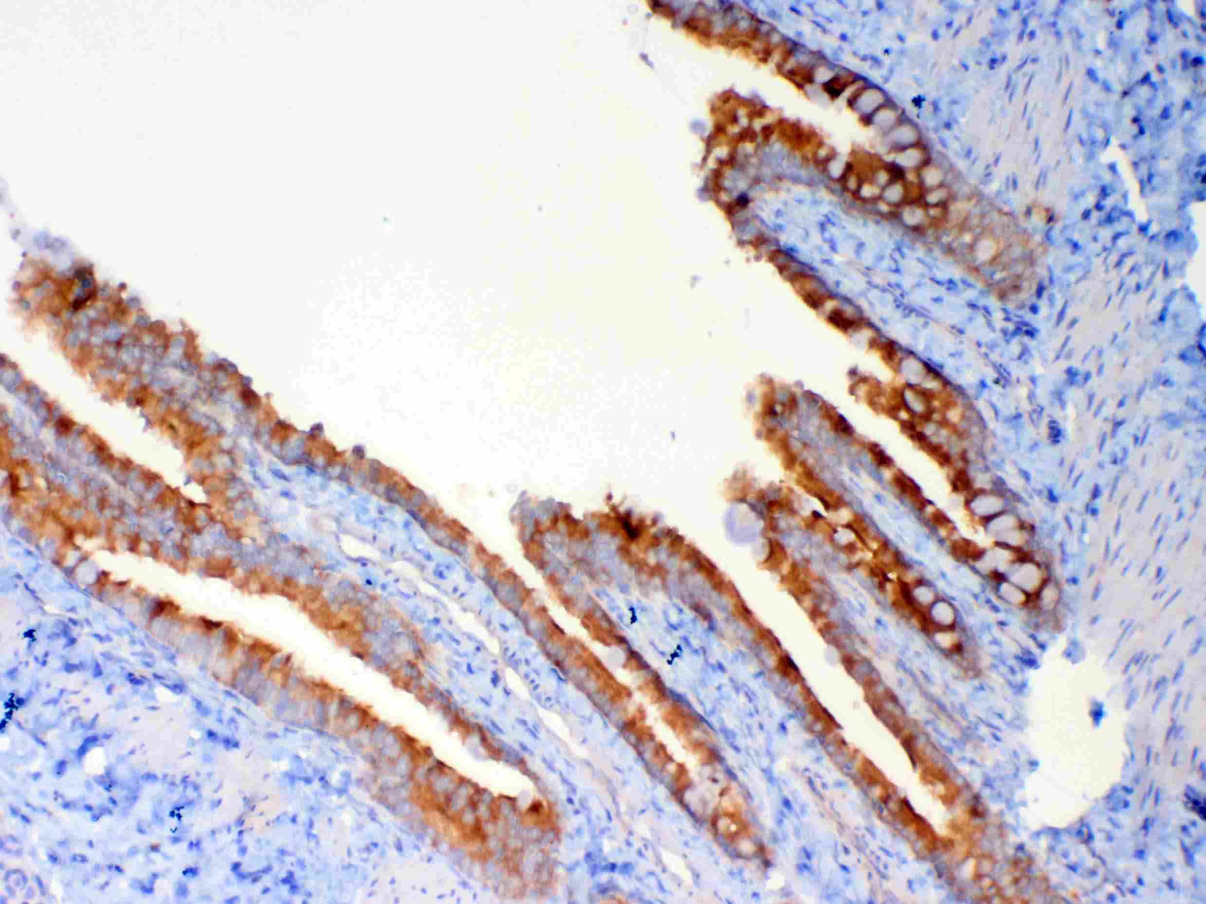 Polyclonal Rabbit anti-Human DYNLT1 / TCTEX-1 Antibody (IHC, WB)