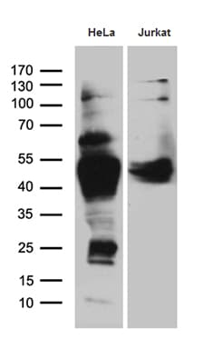 CHIA / Amcase Antibody (clone OTI3H4)