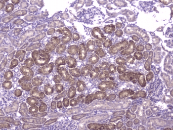 CCL8 / MCP2 Antibody