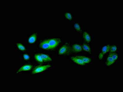 AICAR / ATIC Antibody