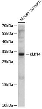 KLK14 / Kallikrein 14 Antibody