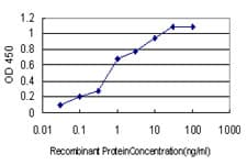 Monoclonal Mouse anti-Human MYOG / Myogenin Antibody (clone 2B7, WB)