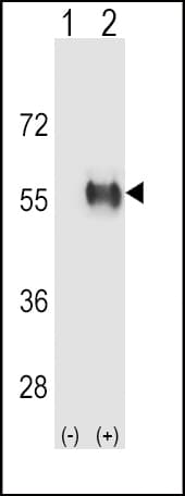 Polyclonal Rabbit anti-Human ALDH3B1 Antibody (aa334-360, IHC, WB)