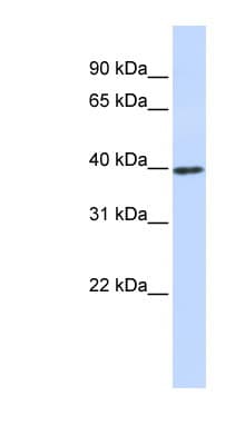 CCND1 / Cyclin D1 Antibody (C-Terminus)