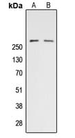 Polyclonal Rabbit anti-Human Acetyl-CoA Carboxylase / ACC Antibody (phospho-Ser80, IHC, WB)