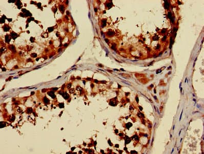 TUBA3C / Tubulin Alpha 3C Antibody