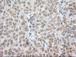 PDE4A / PDE4 Antibody (clone OTI1C8)