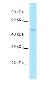 RPL4 / Ribosomal Protein L4 Antibody (aa124-173)