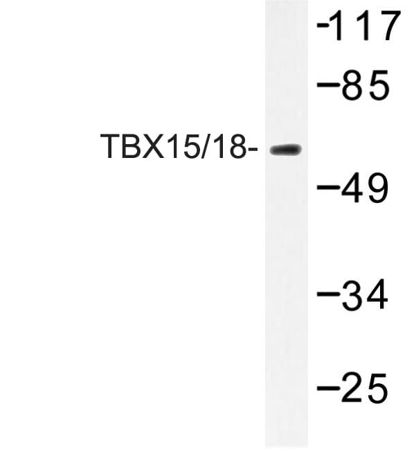 TBX15+18 Antibody (Asp164)