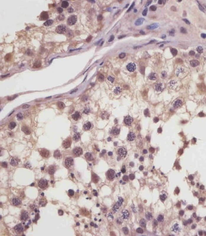 MGEA5 Antibody (N-Terminus)
