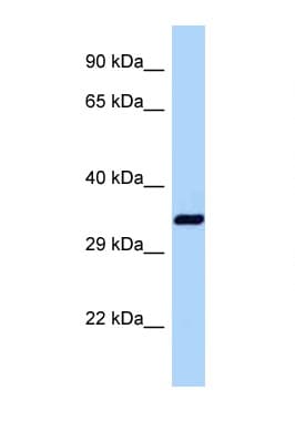 Polyclonal Rabbit anti-Mouse DNAJB1 / Hsp40 Antibody (C-Terminus, WB)
