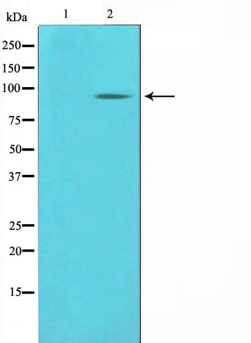 KAT2B / PCAF Antibody