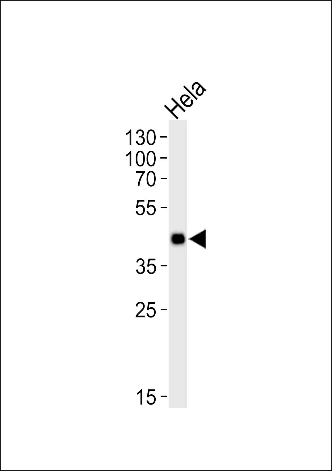MAPKAPK3 Antibody (aa63-90)