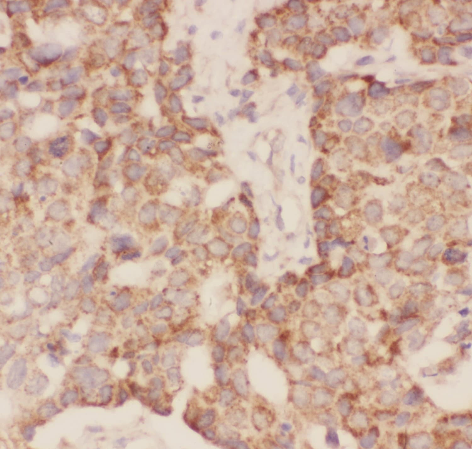 FSHB / FSH Beta Antibody (aa19-129)