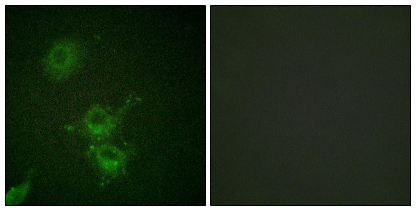 EGFR Antibody (phospho-Thr693)