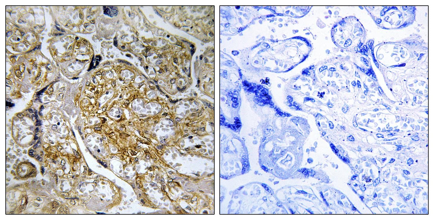 PAK1 Antibody (phospho-Ser199)