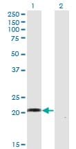 IHC-plus™ CCN5 Antibody (clone 1E11)
