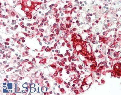 ABCG1 Antibody (aa79-312)