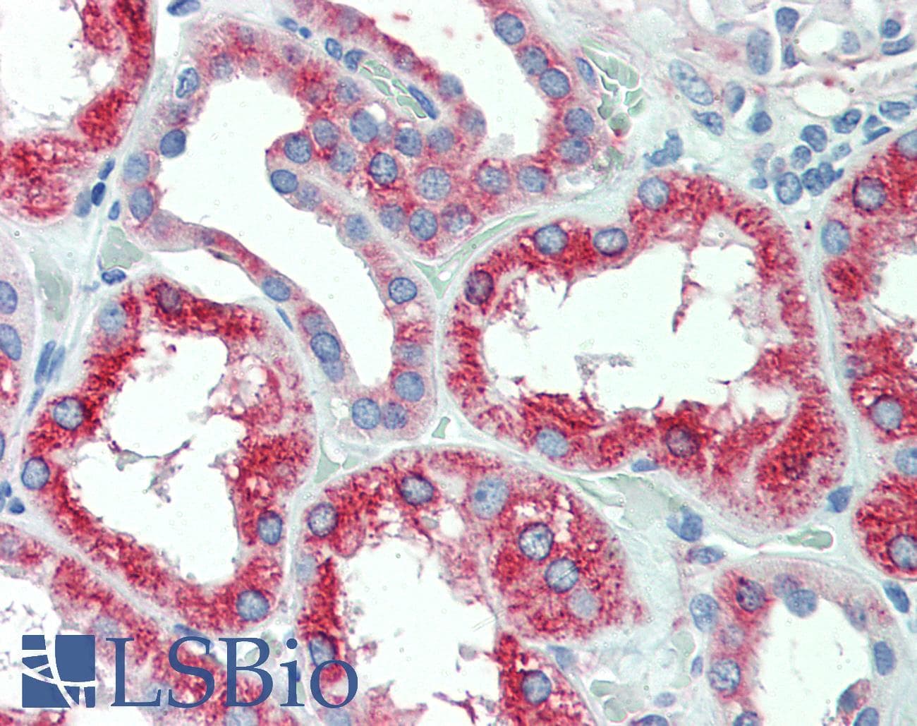 IHC-plus™ SLC11A2 / DMT1 Antibody (Internal)