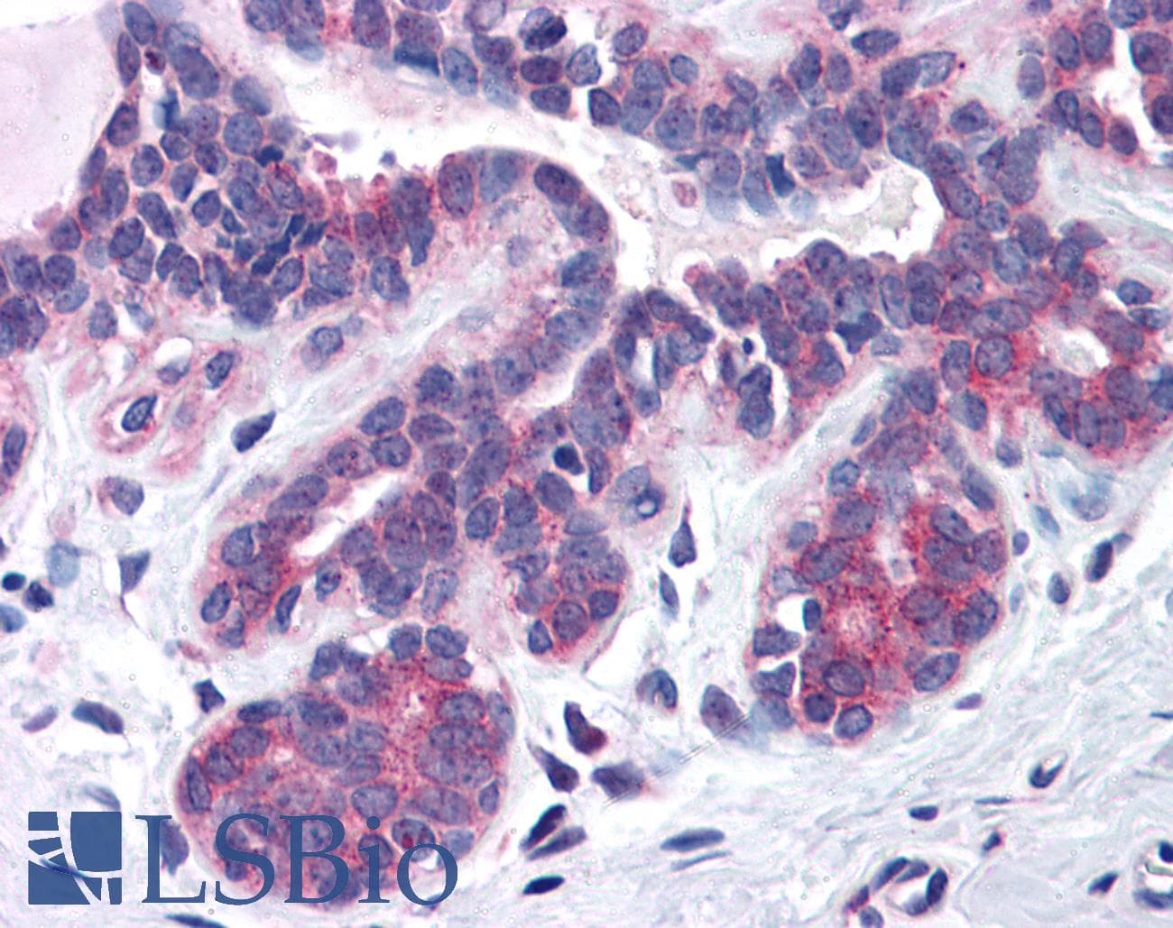 IHC-plus™ SNX16 Antibody (aa2-14)