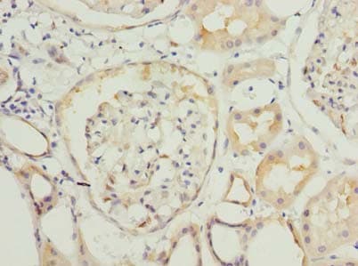 P5CR2 / PYCR2 Antibody