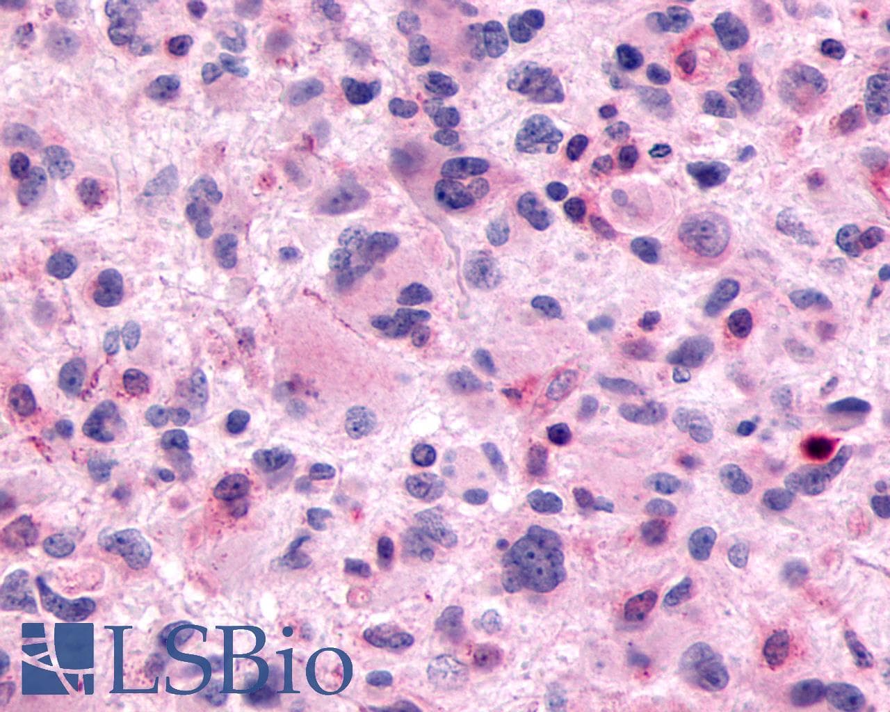 PathPlus™ SSTR3 Antibody (C-Terminus)