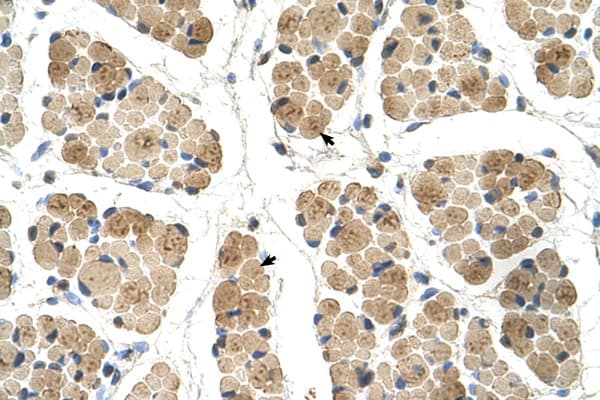 Polyclonal Rabbit anti-Human KLHL31 Antibody (Biotin, aa501-550, IHC, WB)