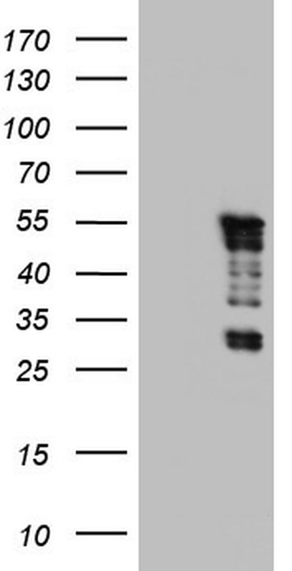 IHC-plus™ Monoclonal Mouse anti-Human TET3 Antibody (clone 11E11, aa241-568, IHC, WB)