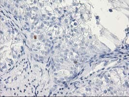C1orf50 Antibody (clone OTI1B11)