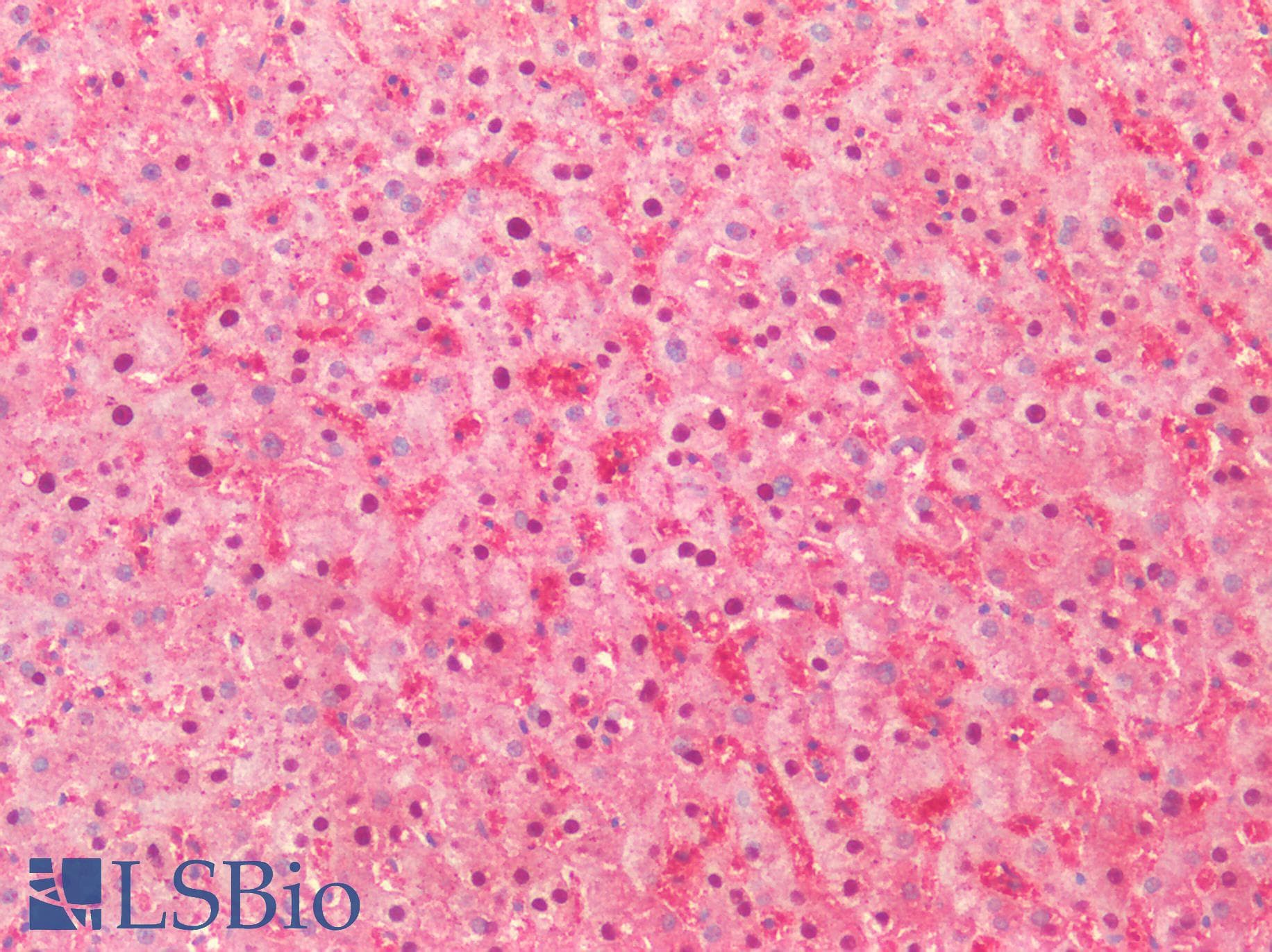 PathPlus™ HDAC4 Antibody