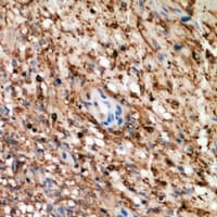 PRDX5 / Peroxiredoxin 5 Antibody