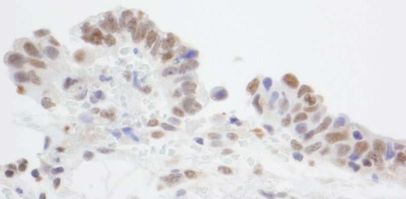 NRSF / REST Antibody (aa1050-C-term)