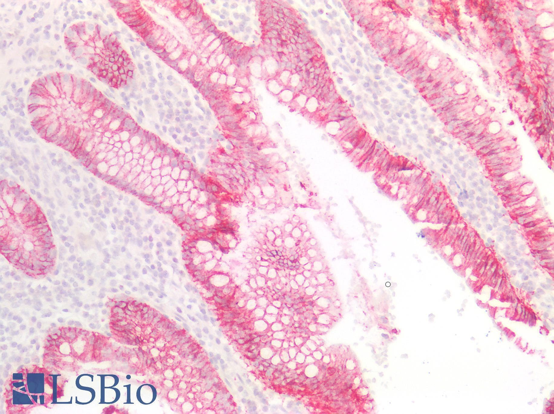 PathPlus™ CLDN4 / Claudin 4 Antibody (130-210 aa, C-terminal)