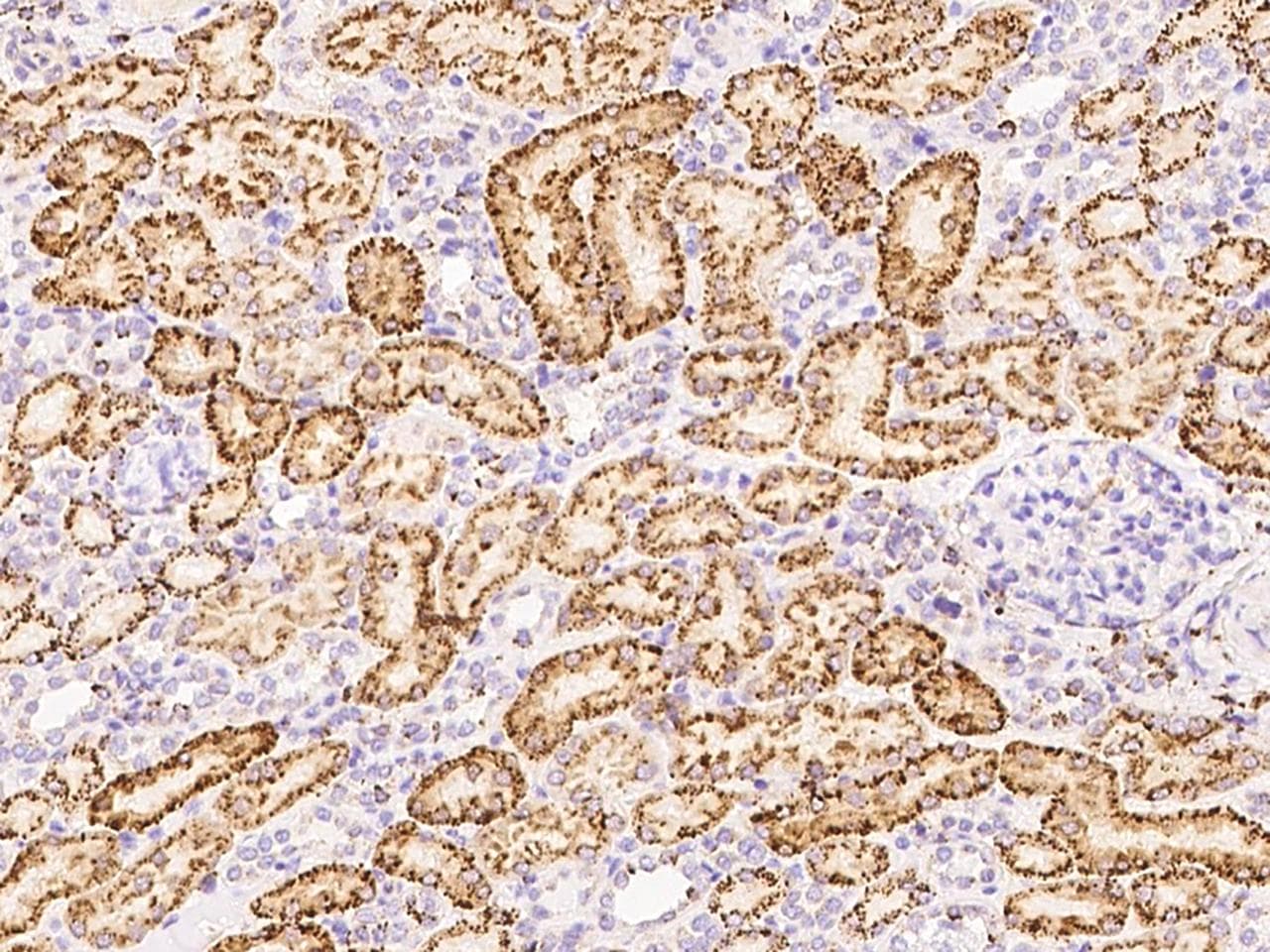 Polyclonal Rabbit anti-Human CTSB / Cathepsin B Antibody (Preservative Free, IHC, WB)