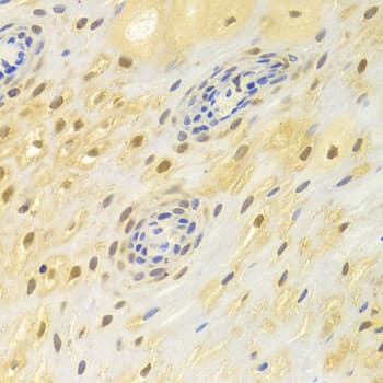 POLB / DNA Polymerase Beta Antibody