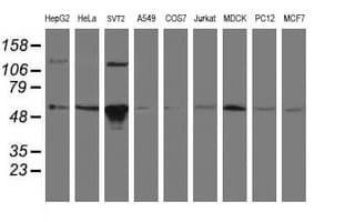 Monoclonal Mouse anti-Human GORAB / SCYL1BP1 Antibody (clone OTI1E3, aa35-394, IHC, WB)