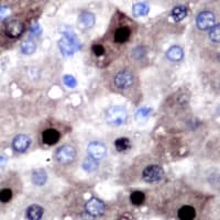 SULT2B1 / Sulfotransferase 2B1 Antibody