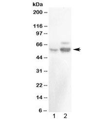 RALDH2 / ALDH1A2 Antibody