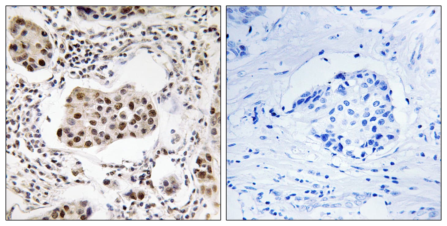 PPP1R11 Antibody (aa71-120)
